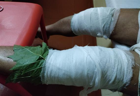 Upanaham - Authentic Ayurvedic Therapy at Vedicare